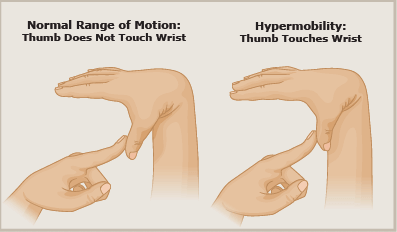 How to Tell if You're Double Jointed